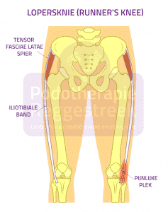 https://www.podotherapiereggestreek.live/wp-content/uploads/2019/01/lopersknie-runners-knee-podotherapie-reggestreek-rijssen.png